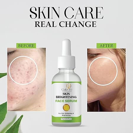 Skin Brightening Face Serum for Skin Whitening & Brightening, 30 ml