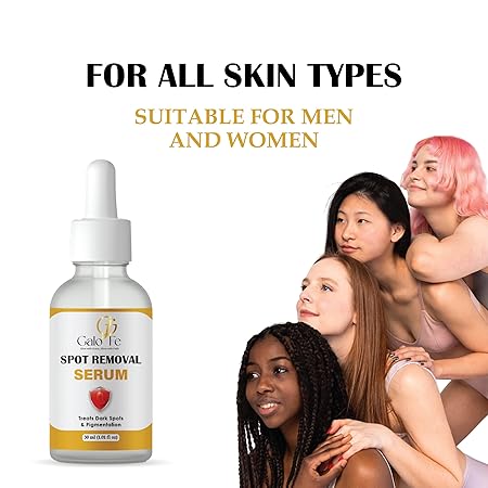 Spot Removal Serum, Dark Spot Correction, Skin Brightening, Alpha Arbutin 2%, Liquid, 30 ml