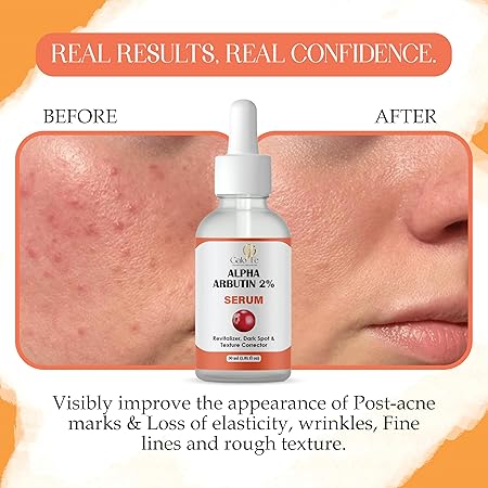 Alpha Arbutin 2% Serum, Dark Spot and Texture Corrector, Revitalizer, Even Skin Tone, 30 ml