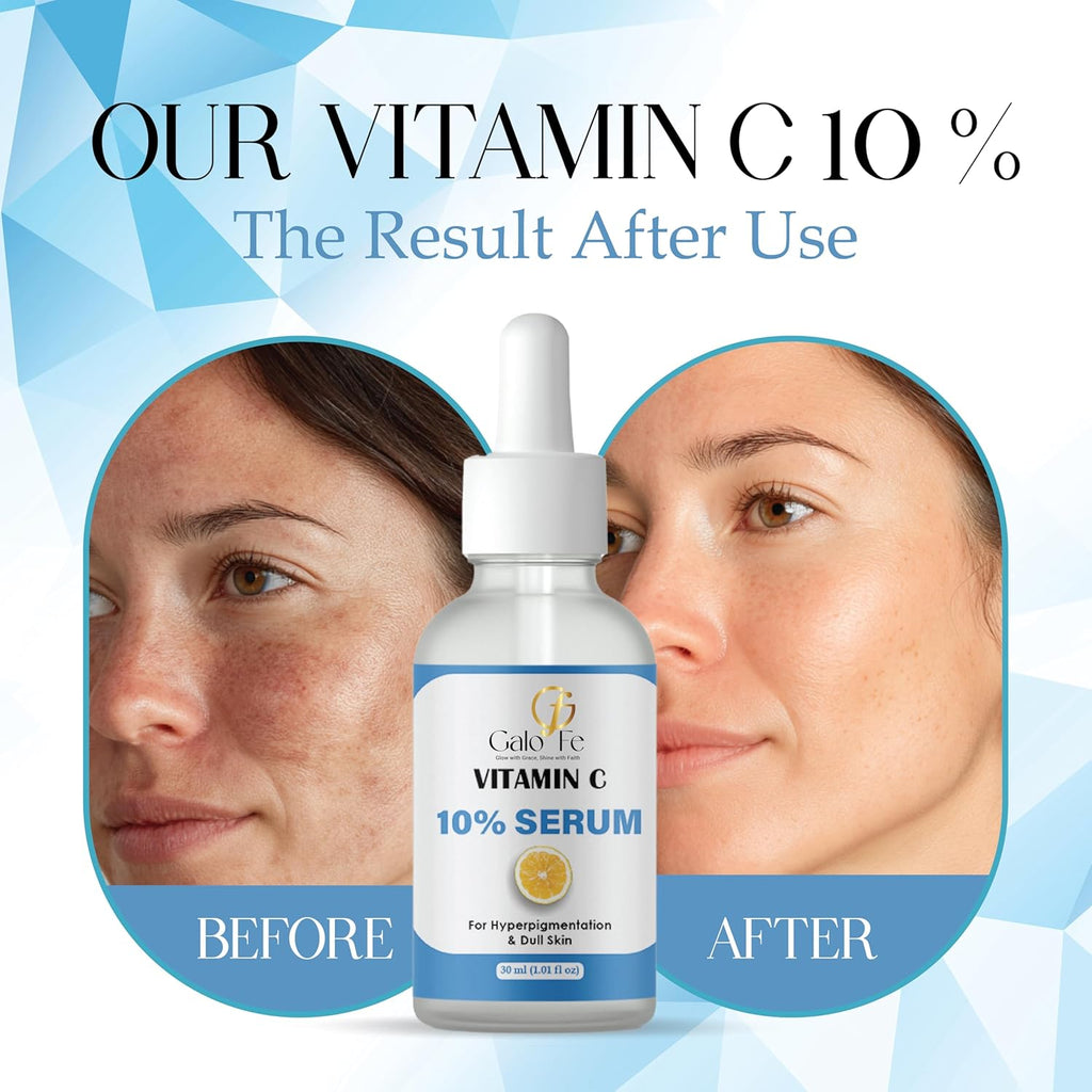 Galo Fe Vitamin C 10% Face Serum, 30 ml, for Dark Spot Correction, Skin Brightening, with Alpha Arbutin 2%, Paraben Free