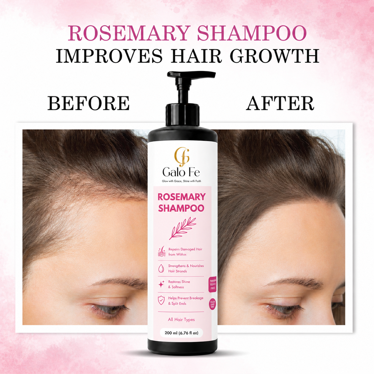 Galo Fe  Rosemary Shampoo, Repairs Damaged Hair, Strengthens & Nourishes, Paraben & Sulphate Free, All Hair Types, 200 ml