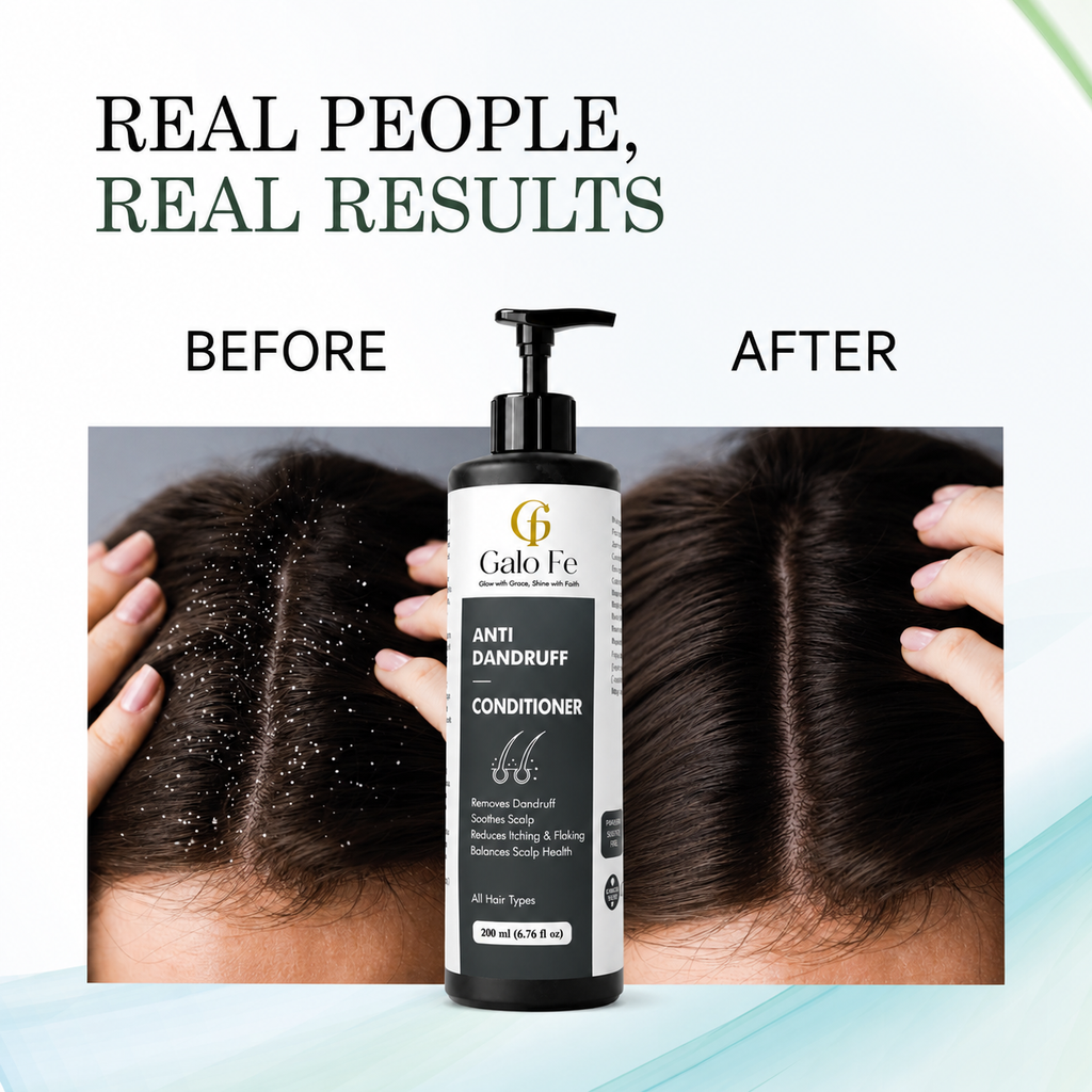 Galo Fe Anti Dandruff Conditioner, Paraben and Sulphate Free, Rice Water Infused, for All Hair Types, 200 ml