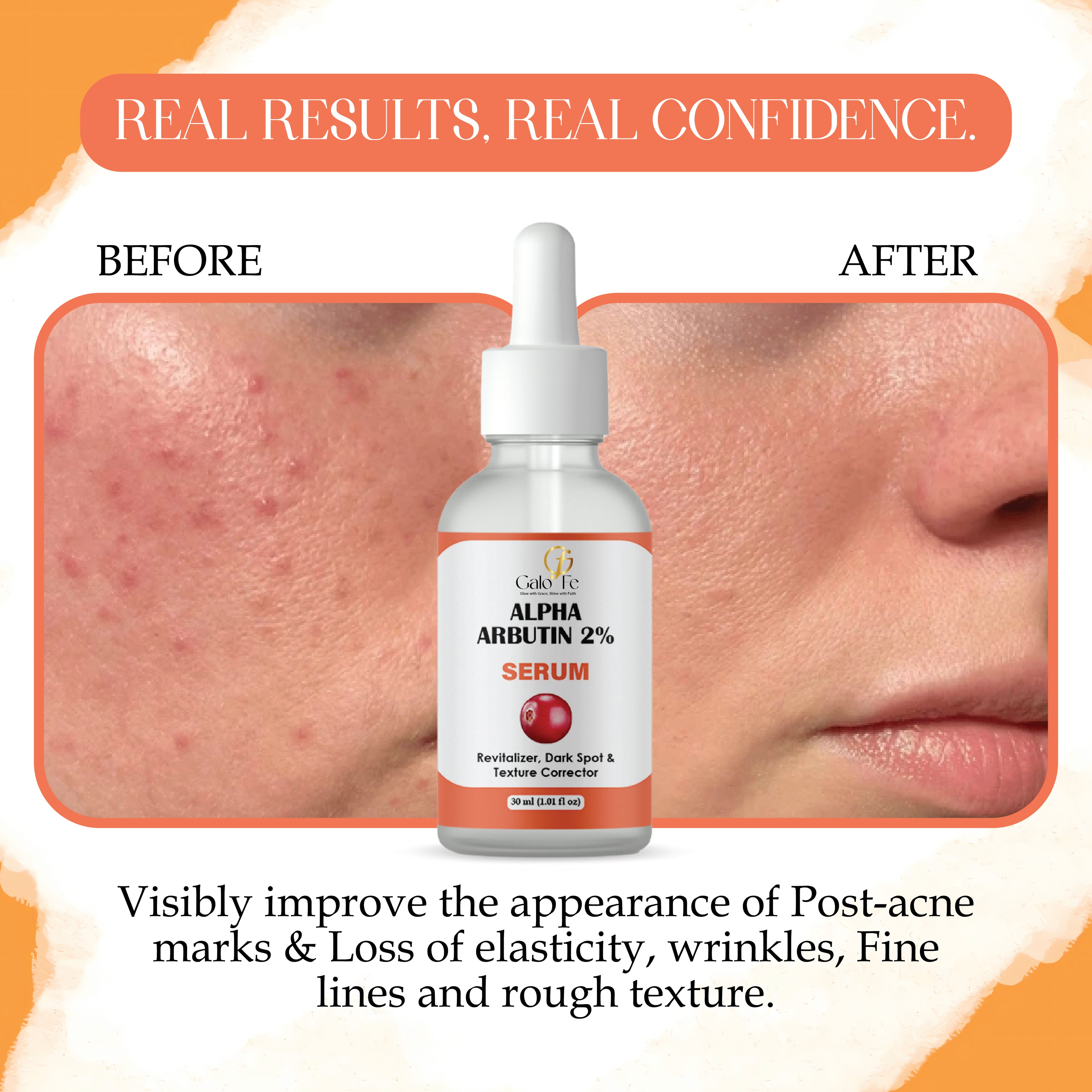 Galo Fe Alpha Arbutin 2% Serum, Dark Spot and Texture Corrector, Revitalizer, Even Skin Tone, 30 ml
