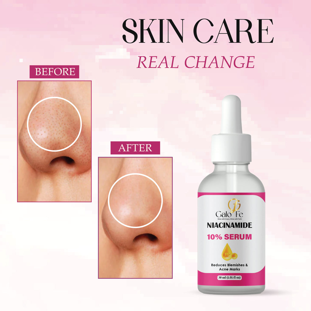 Galo Fe Niacinamide 10% Serum, Reduces Blemishes and Acne Marks, Face Serum, 30 ml